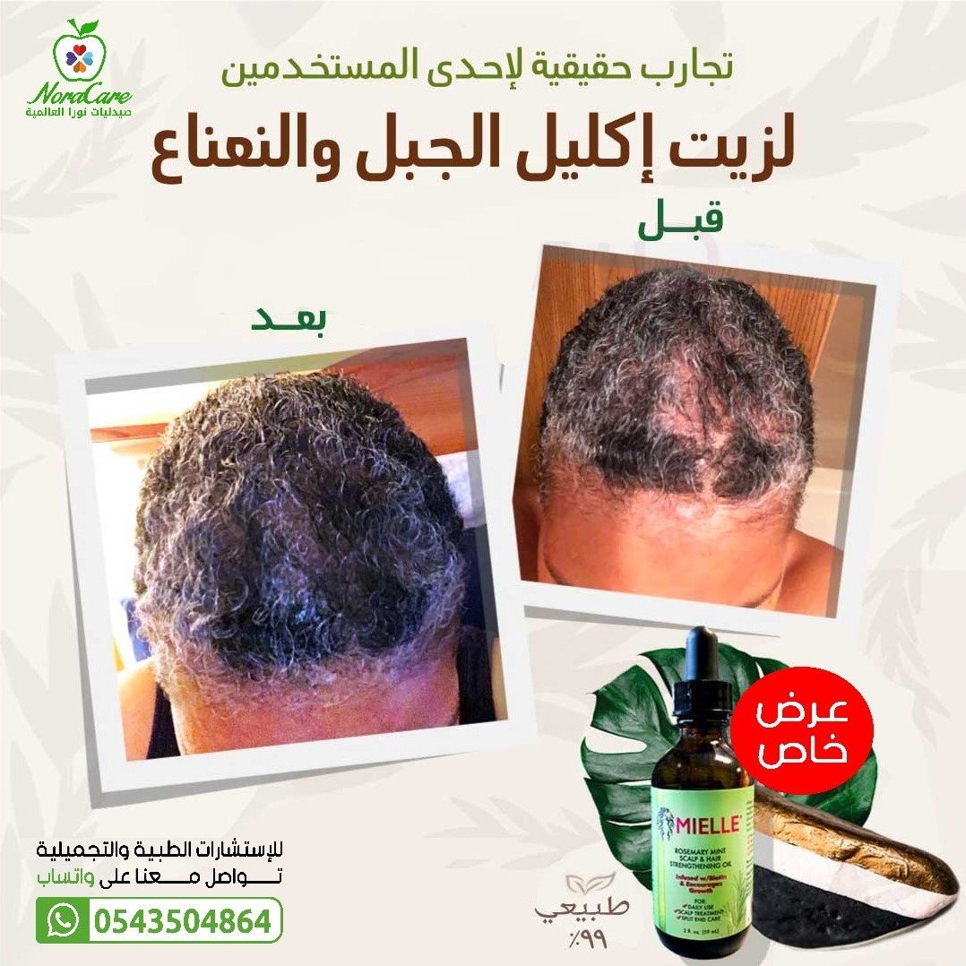 زيت ميلي زيت روزماري لتغذية الشعر - الصورة 8