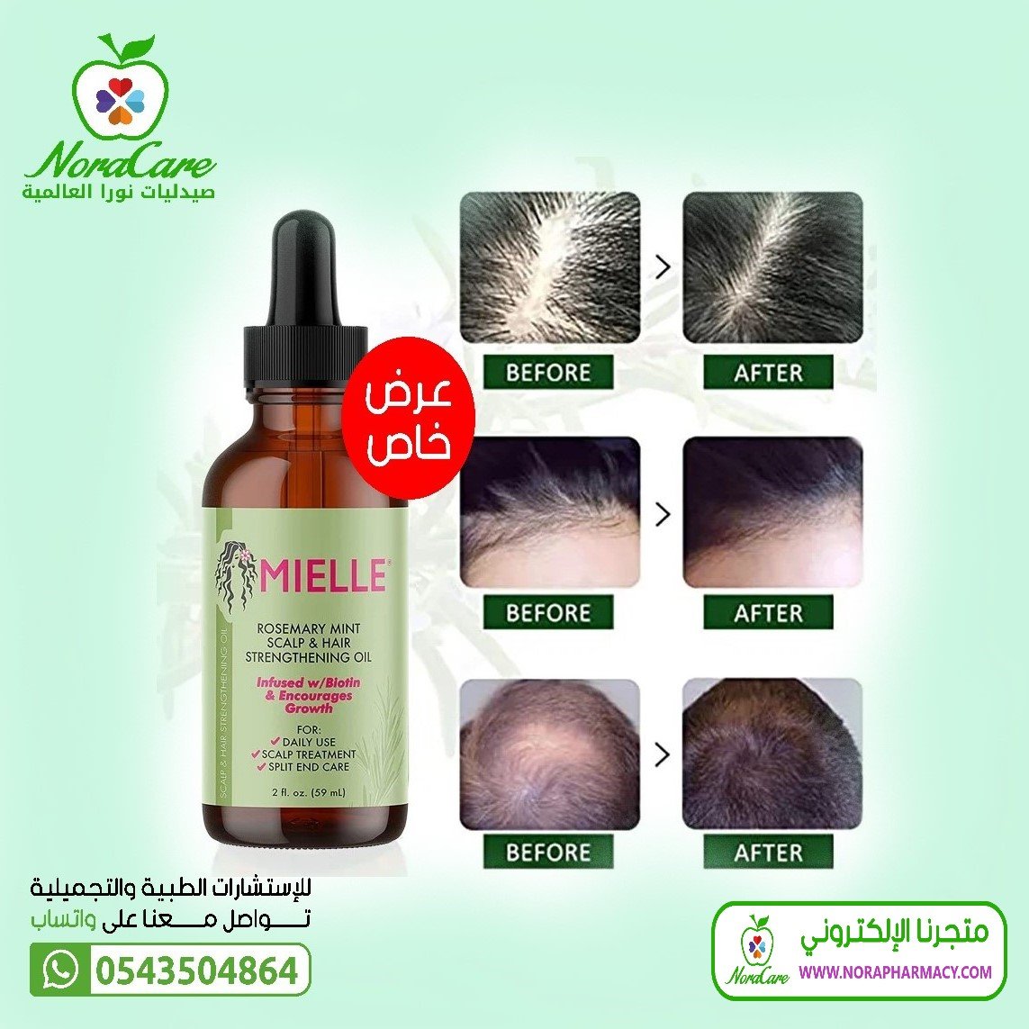 زيت ميلي زيت روزماري لتغذية الشعر - الصورة 2