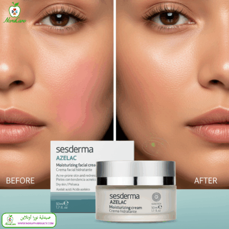 ⁦Sesderma AZELAC MOISTURIZING FACIAL CREAM⁩ - الصورة ⁦6⁩