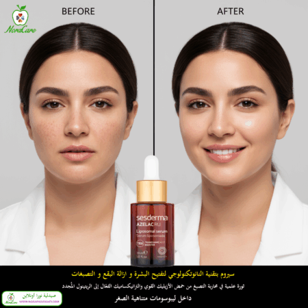 ⁦Sesderma AZELAC RU LIPOSOMAL SERUM 30 ML⁩ - الصورة ⁦4⁩