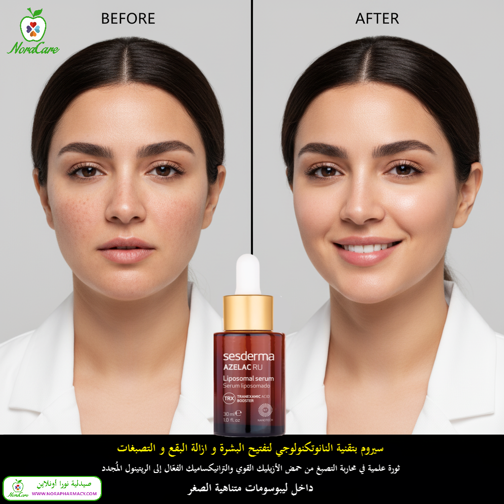 Sesderma AZELAC RU LIPOSOMAL SERUM 30 ML - الصورة 4