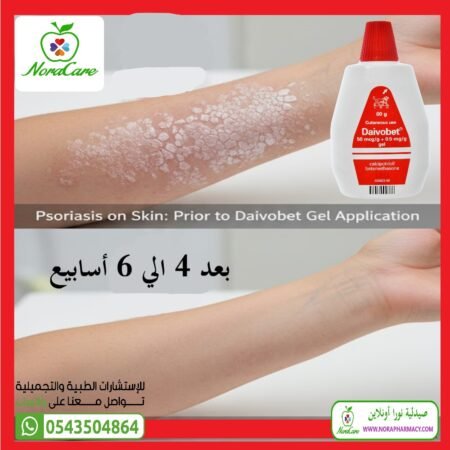 ⁦دايفوبيت جل Daivobet GEL 60 Gm⁩ - الصورة ⁦2⁩