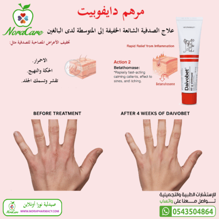 ⁦دايفوبيت مرهم Daivobet Ointment 60 Gm⁩ - الصورة ⁦2⁩