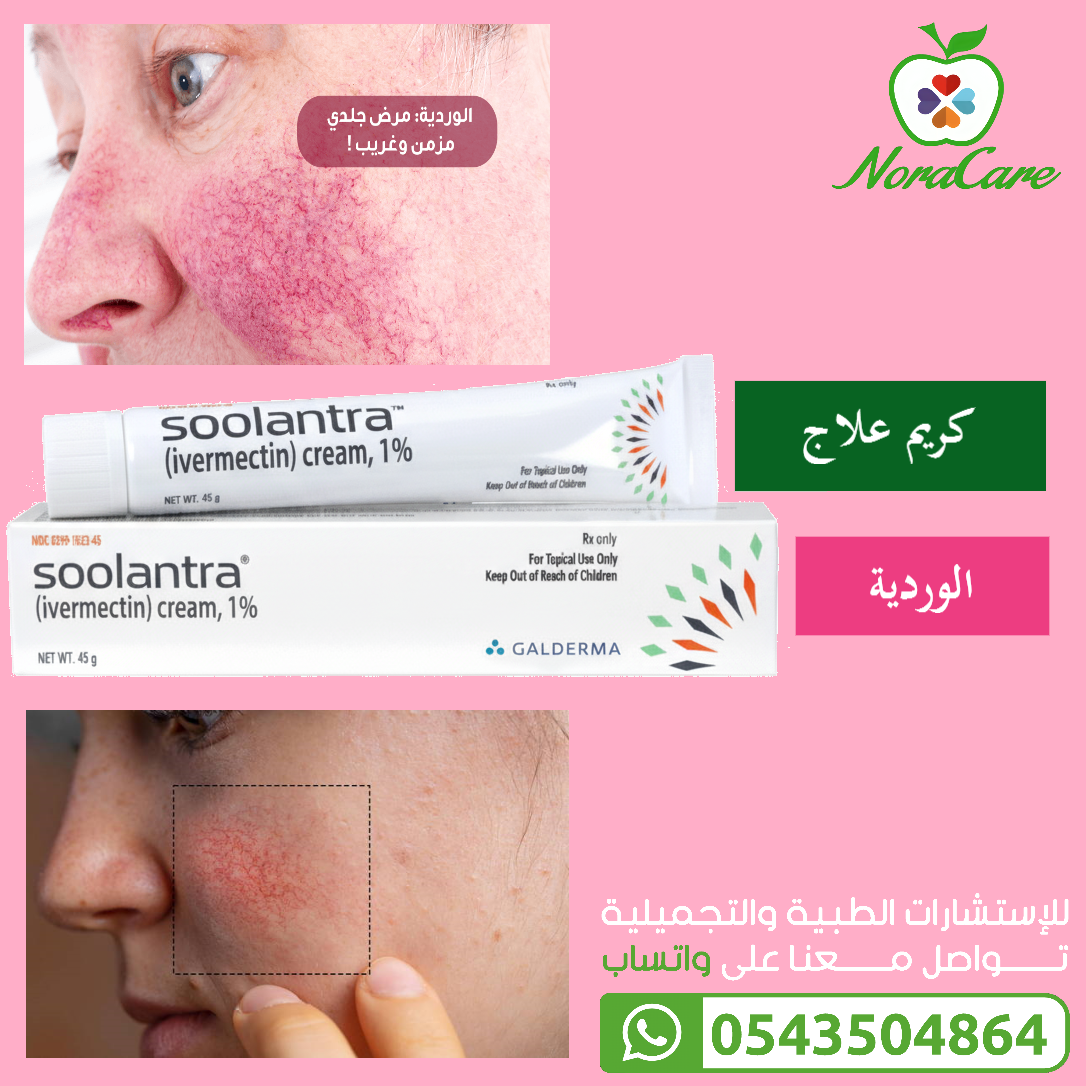سولانترا كريم SOOLANTRA CREAM - الصورة 2