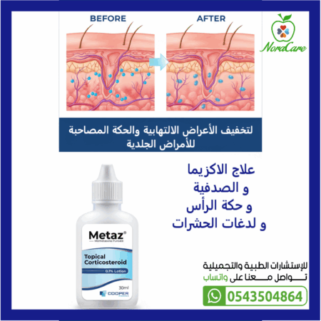 ⁦ميتاز لوشن 0.1% كورتيكوستيرويد موضعي METAZ LOTION⁩ - الصورة ⁦4⁩