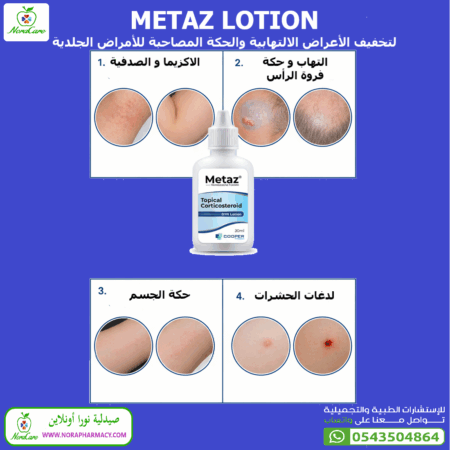 ⁦ميتاز لوشن 0.1% كورتيكوستيرويد موضعي METAZ LOTION⁩ - الصورة ⁦7⁩