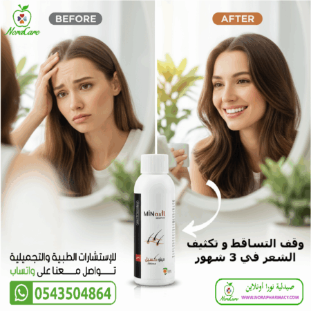⁦مينوكسيل 5 % محلول MINOXIL SOLUTION⁩ - الصورة ⁦6⁩