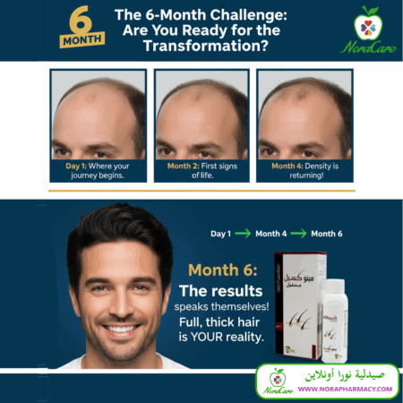 ⁦مينوكسيل 5 % محلول MINOXIL SOLUTION⁩ - الصورة ⁦3⁩