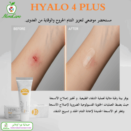 ⁦هيالو 4 بلس كريم HYALO 4 PLUS⁩ - الصورة ⁦4⁩