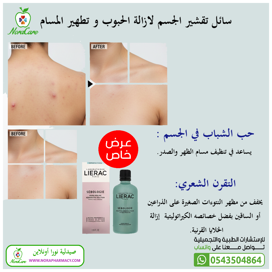 سائل مقشر الساليسيليك و الجليكوليك ليراك LIERAC SEBOLOGIE MICRO PEELING - الصورة 5