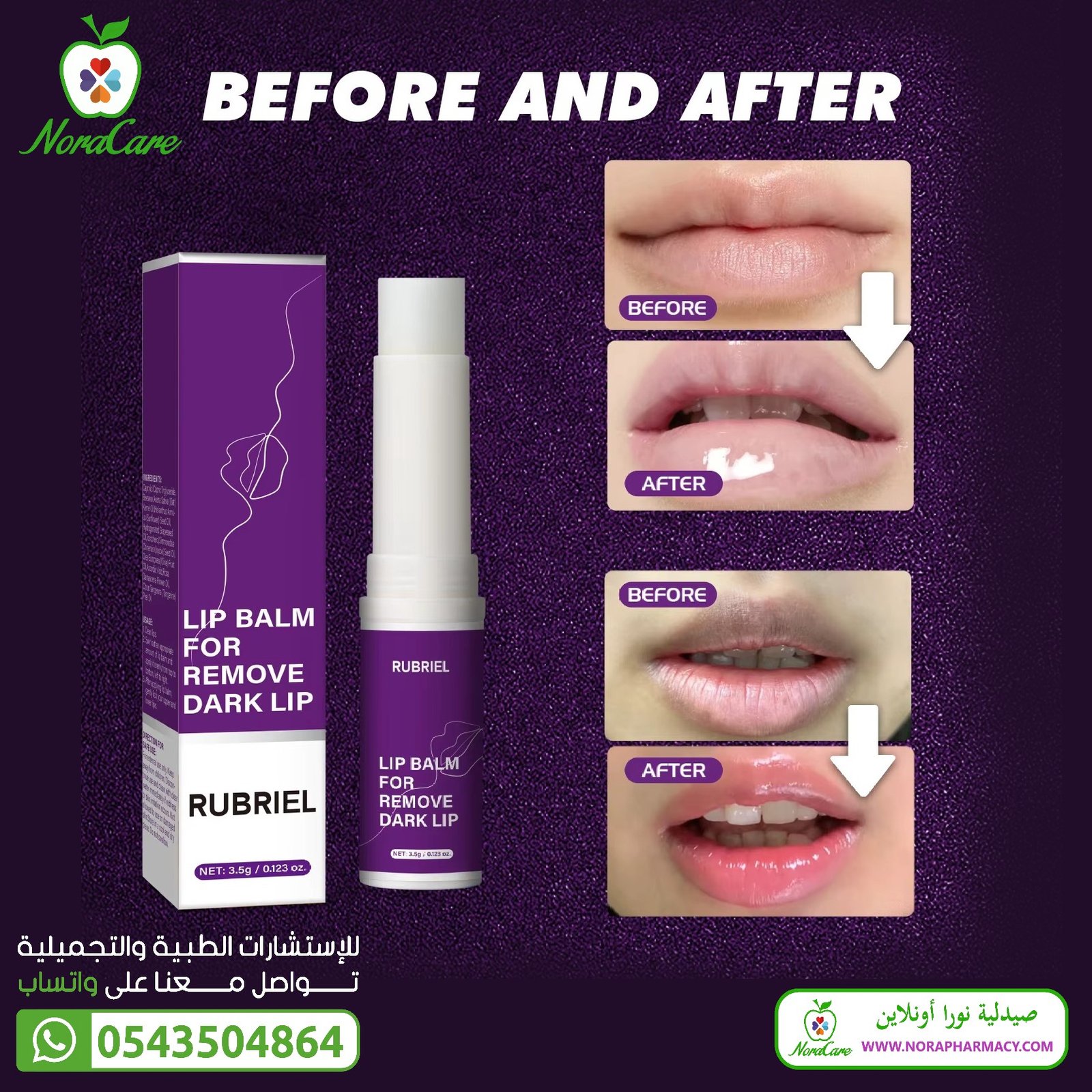 تفتيح الشفايف السوداء و ترطيبها RUBRIEL LIP BALM FOR REMOVE DARK LIP - الصورة 3