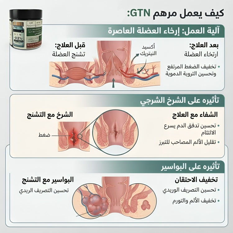 GTN OINTMENT مرهم gtn للشرخ الشرجي جي تي ان - الصورة 3