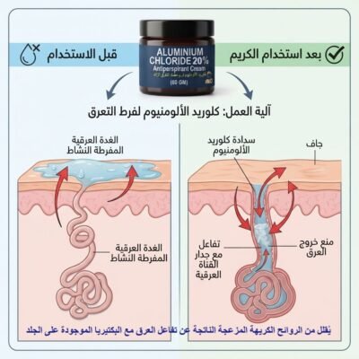 كلوريد الألومنيوم مزيل عرق