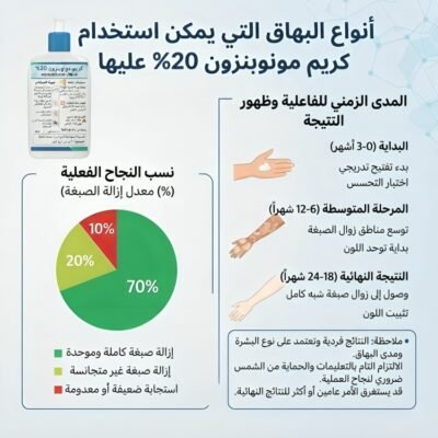MONOBENZONE كريم مونوبنزون كريم توحيد لون البهاق