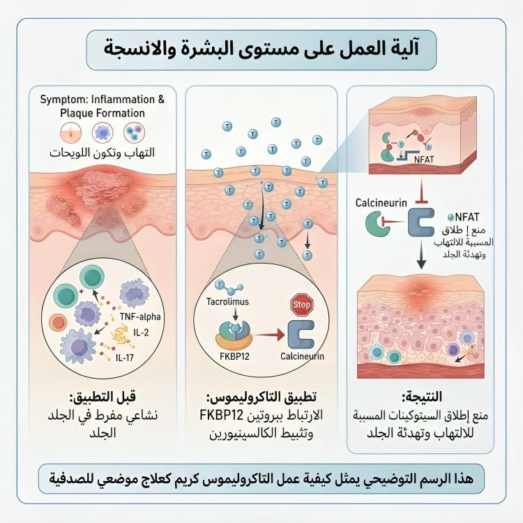 تاكروليموس كريم علاج الصدفية Tacrolimus cream for psoriasis treatment - الصورة 4
