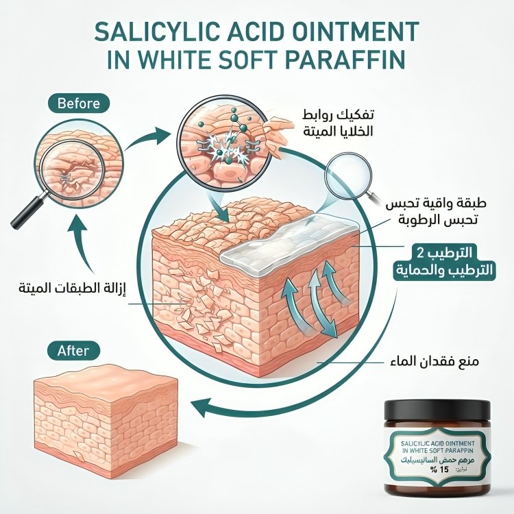 سالسيلك اسيد كريم SALICYLIC ACID 15 % OINTMENT - الصورة 2