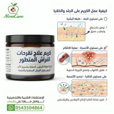 كريم علاج تقرحات الفراش