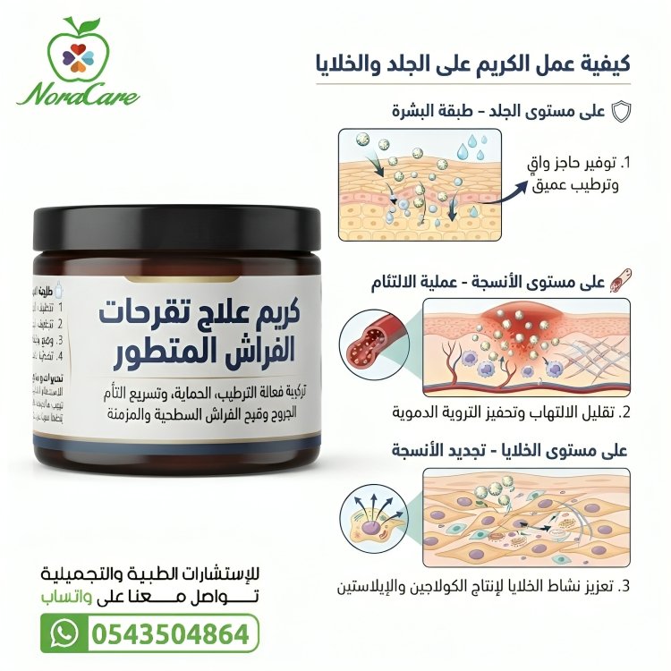 كريم علاج تقرحات الفراش ( تركيبة تحضيرية خاصة ) - الصورة 3