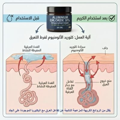 كلوريد الألومنيوم مزيل عرق