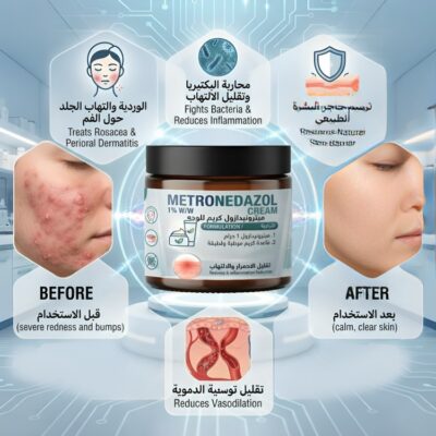 ميترونيدازول كريم للوجه METRONEDAZOL CREAM