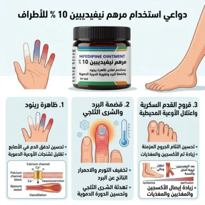 Nifedipine ointment 10% نفيديبين مرهم