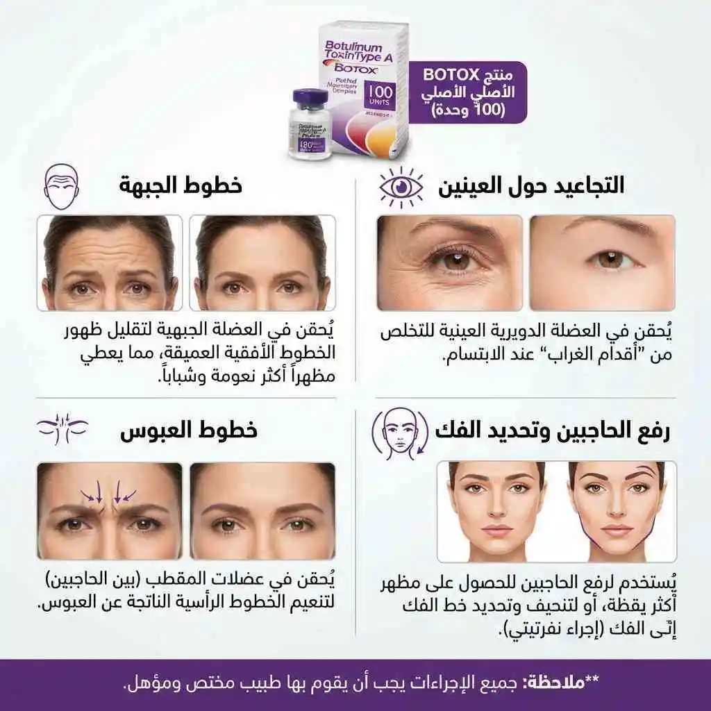 بوتكس اليرجان Allergan Botox 100 UNIT - الصورة 6