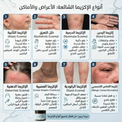 علاج اكزيما ديرما ريبير 5% يوريا DermaRepair