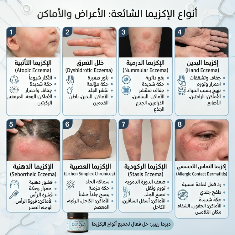علاج اكزيما ديرما ريبير 5% يوريا DermaRepair - الصورة 2